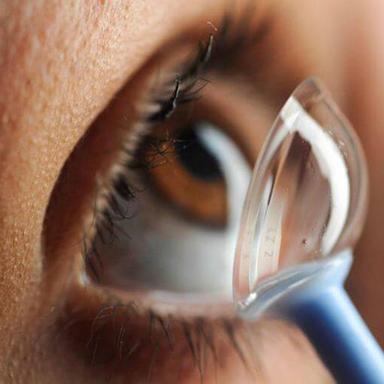 Transparent Scleral Lens