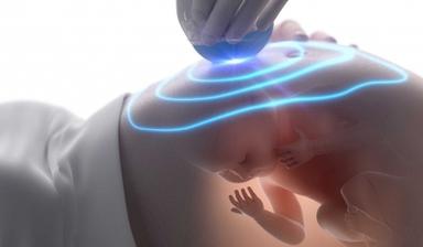 Low Power Consumption Ultrasound Machine