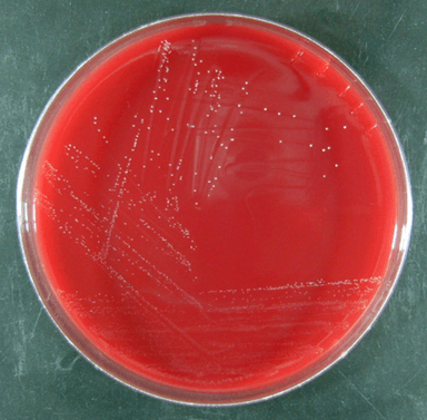 Brucella Blood Agar W Hemin And Vitamin K1 Application: Na