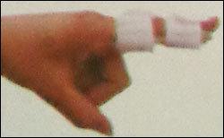 Straight Splint