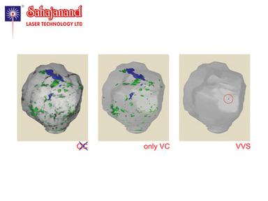 Diamond Auto Inclusion Detection System