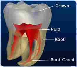 Single Sitting Root Canal Treatment