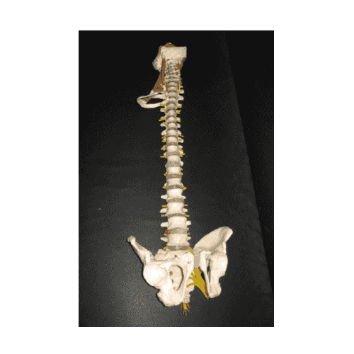 Pathological Spine Model