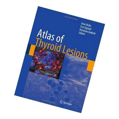 Atlas Of Thyroid Lesions Book Audience: Adult