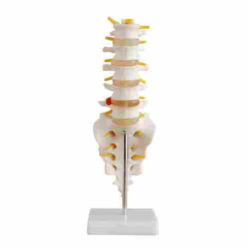 XC-119  Life Size Lumbar Vertebrae With Sacrum And Coccyx And Herniated Disc