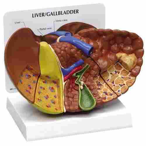 SI/AN-541 The Model Of Diseased Liver Cancer