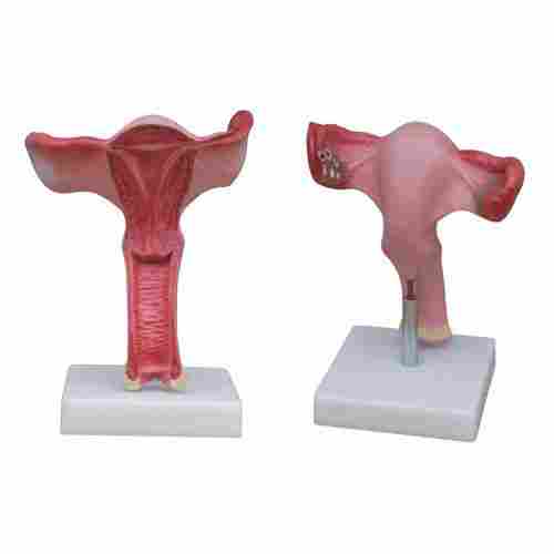 XC-436A  Magnified Uterus Model