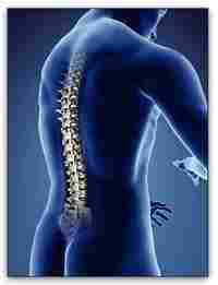 Orthopaedic Spinal Implants