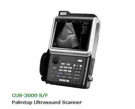 Palm Ultrasound Scanner