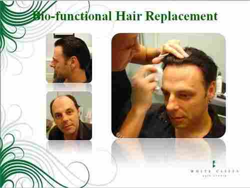 Non-Surgical Hair Replacements