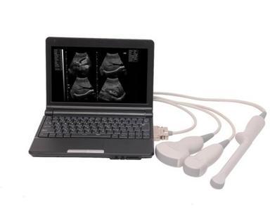 Laptop Ultrasonic Diagnostic System U609