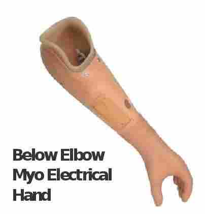 Below Elbow Myo Electrical Hand