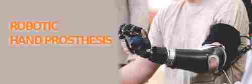 Robotic Hand Prosthetic