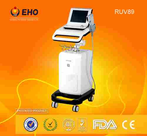 RUV89 Ebay Europe High Intensity Focused Ultrasound System