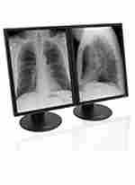 Dome S3 LED Grayscale Radiology Display