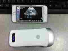 Infoyuga Wireless Ultrasound