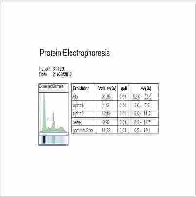 Electrophoresis Analyzer Software