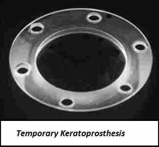 Temporary Keratoprosthesis