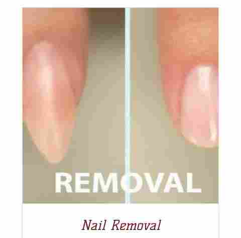 Nail Removal Services