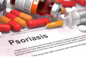 Psoriasis Medical Treatment Service