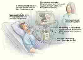 Respiratory Care Medical Machine
