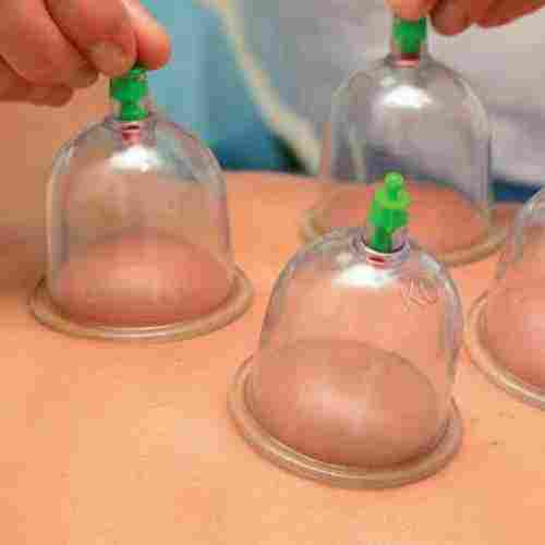 Hijama Cup Therapy Service