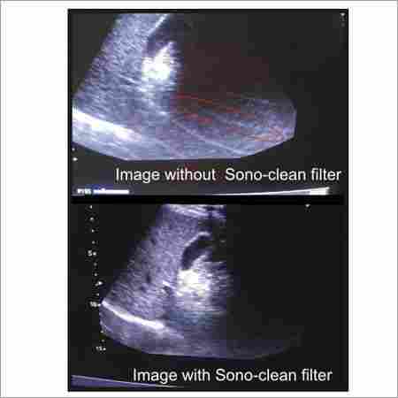 EMI Filter for Ultrasound Scanners