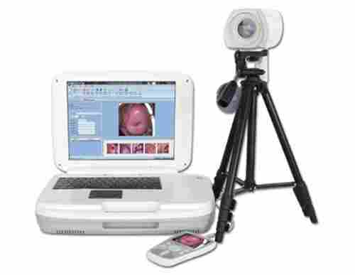 YKD-3004 Portable Digital Colposcope