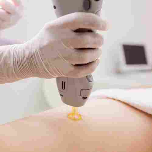 Hair Removal Cosmetic Laser Service