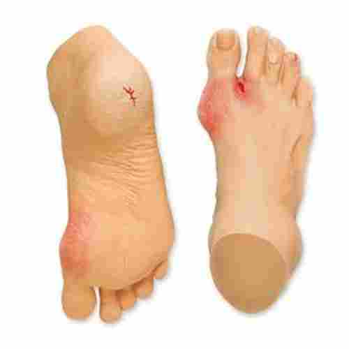 Common Foot Problem Anatomy Model