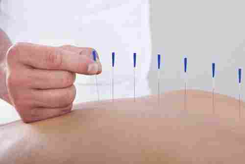 Acupuncture Therapy Treatment Services