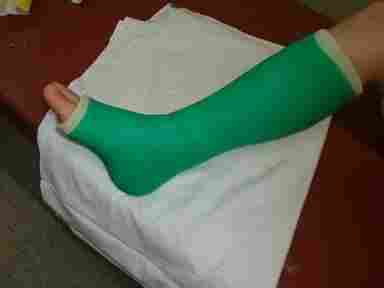 Surgical Foot Casting Tape