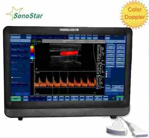 C8 Color Doppler Ultrasound System (Touch Screen)