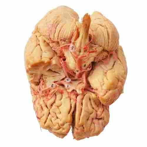 Basilar Artery Of Plastinated Human Brain Specimen