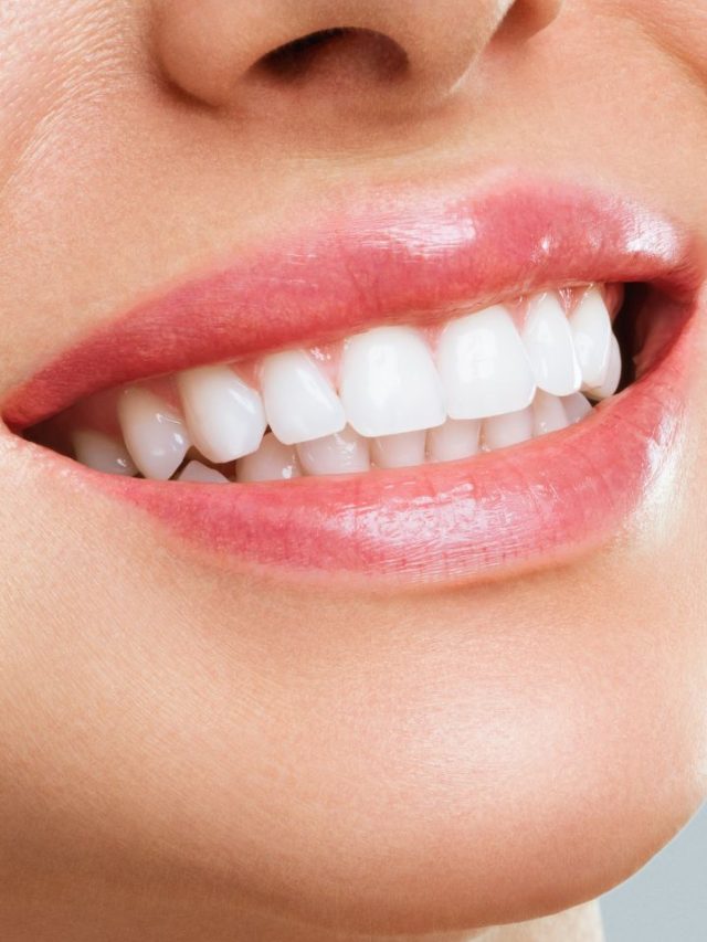 					Want Healthier Teeth? Try These Power Packed Veggies!				
